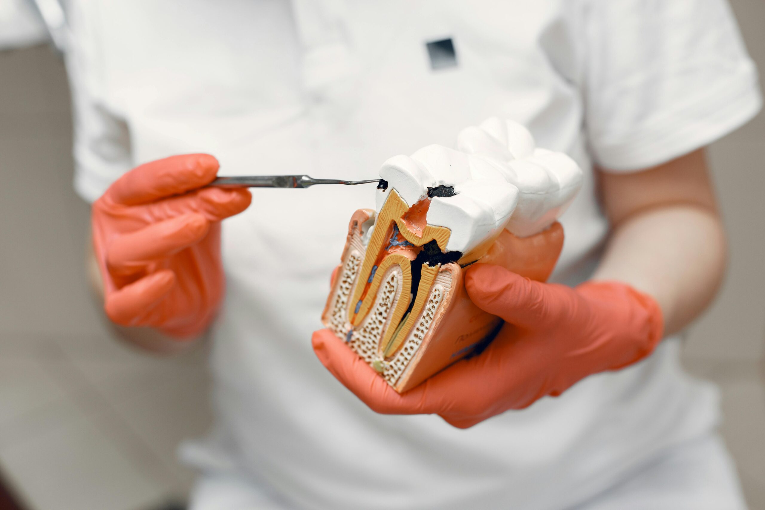 Dentist explaining a root canal procedure.